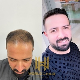 World Of The Hair