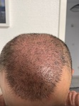 Dymed Hair Clinic Yorum Resmi