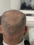 Dymed Hair Clinic Yorum Resmi