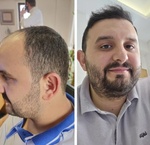 Estefine Saç Ekim Merkezi Yorum Resmi